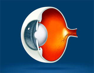 cold lake eye care Treatment of Ocular Disease