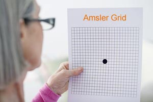 macular degeneration